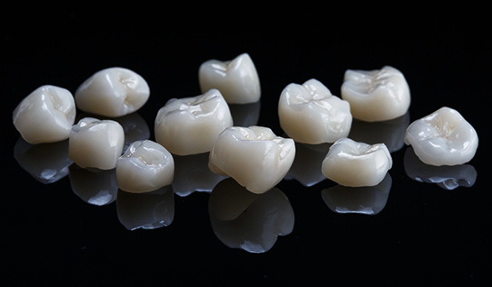 Close-up of metal-free restorations on black surface