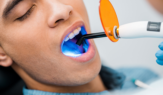 Male dental patient receiving cosmetic dental bonding