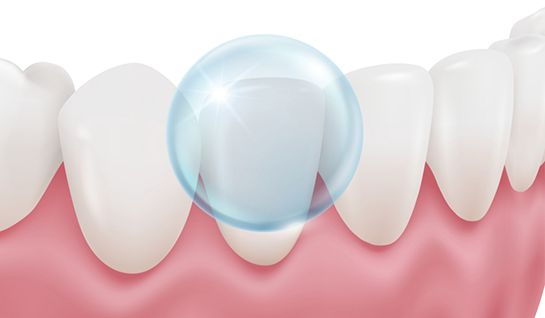 Illustration of fluoride applied to tooth