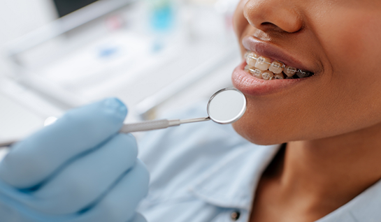 Close up of dental mirror and smile with braces